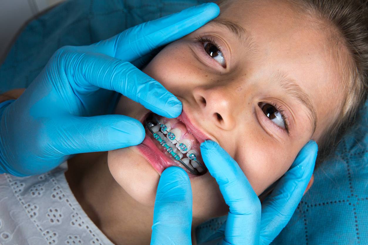 orthodontie pour enfants